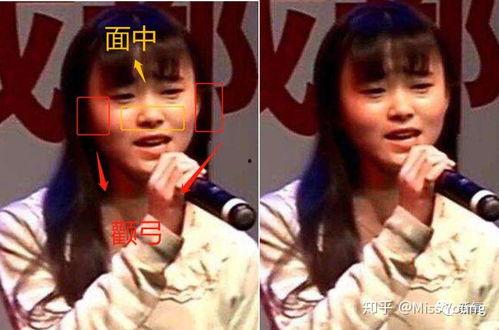 鞠婧祎整容前后照片,美丽蜕变之路